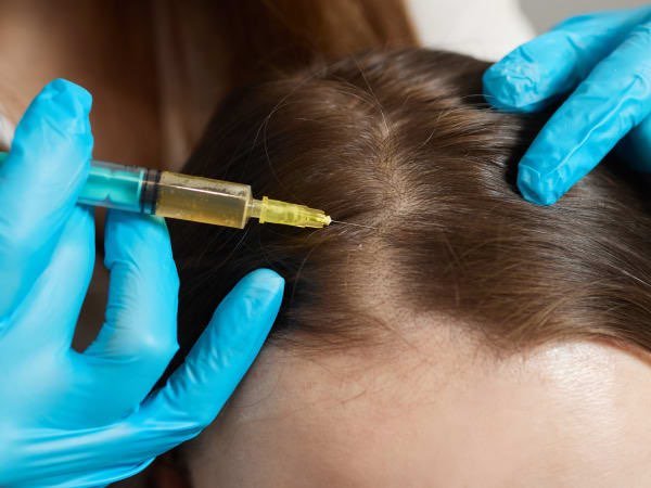 PRP Hair Growth Therapy